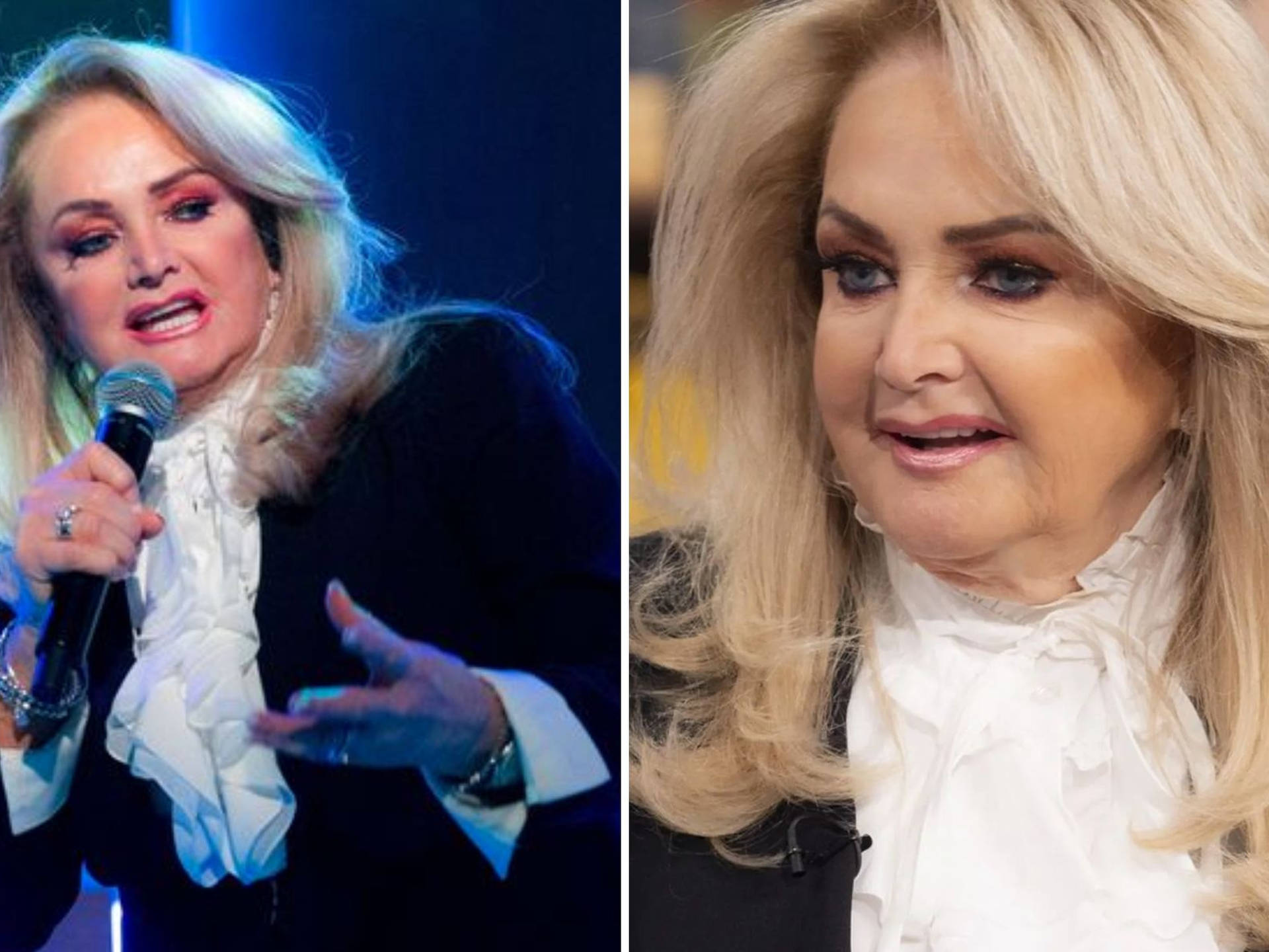 Bonnie Tyler Plastic Surgery Procedures