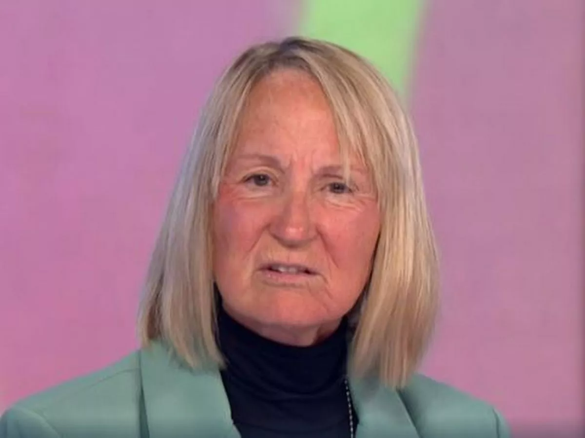 Carol McGiffin Cosmetic Surgery Face