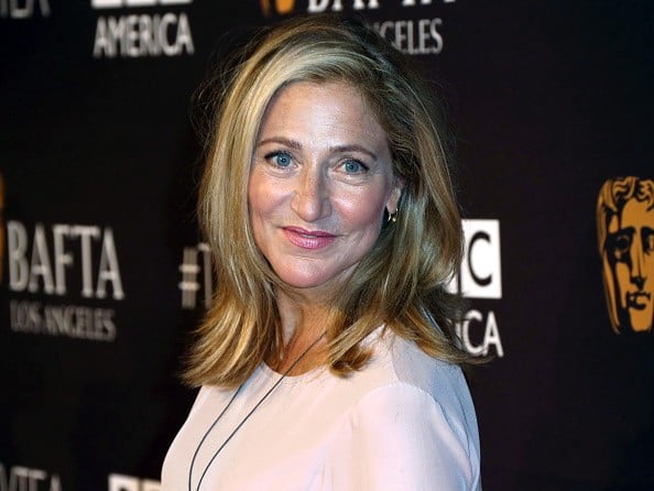 Edie Falco Plastic Surgery