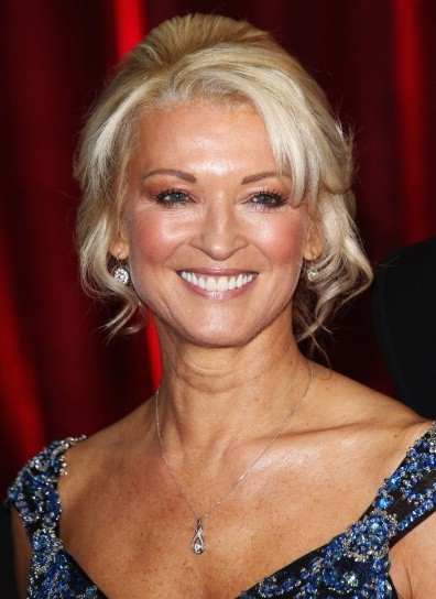 Gillian Taylforth Plastic Surgery Face