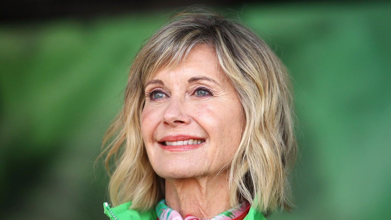 Olivia Newton-John Cosmetic Surgery Face