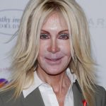 Joan Van Ark Plastic Surgery and Body Measurements