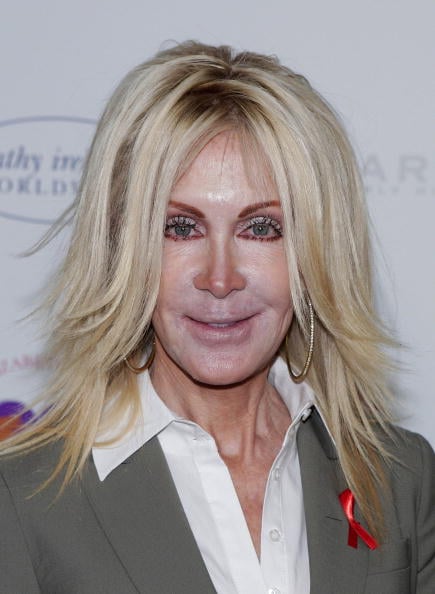 Has Joan Van Ark Had Plastic Surgery? Body Measurements and More!