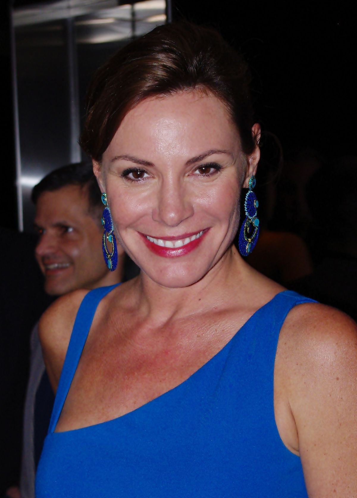 LuAnn de Lesseps Cosmetic Surgery Face