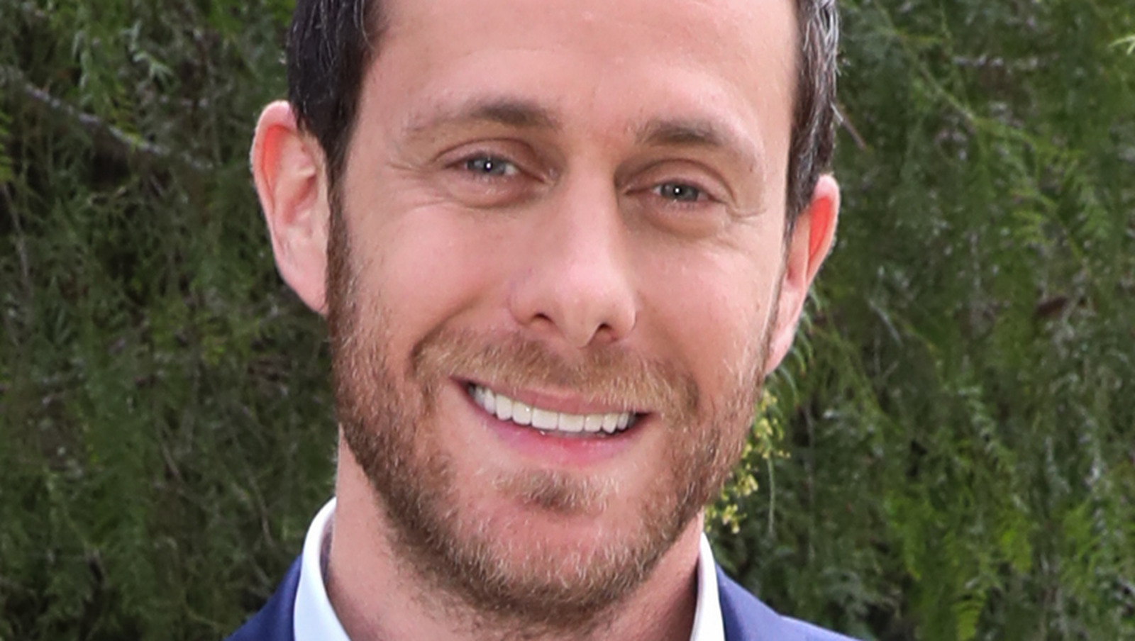 David Parnes: Inside His Nose Job and Plastic Surgery Journey
