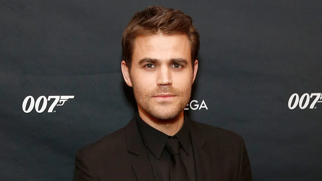 Paul Wesley’s Subtle Changes: Botox and Cheek Refinements Discussed