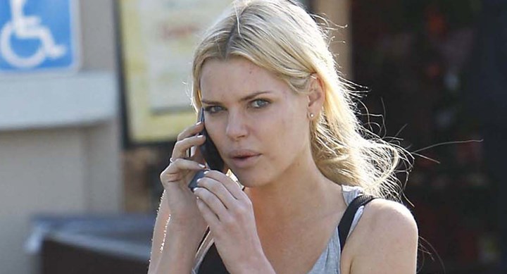 Sophie Monk’s Candid Journey with Plastic Surgery: Filler and More