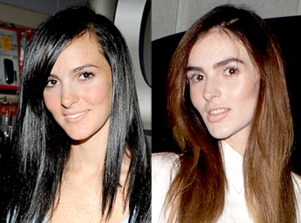 Ali Lohan’s Speculated Plastic Surgery: Rhinoplasty and Lip Fillers Explored