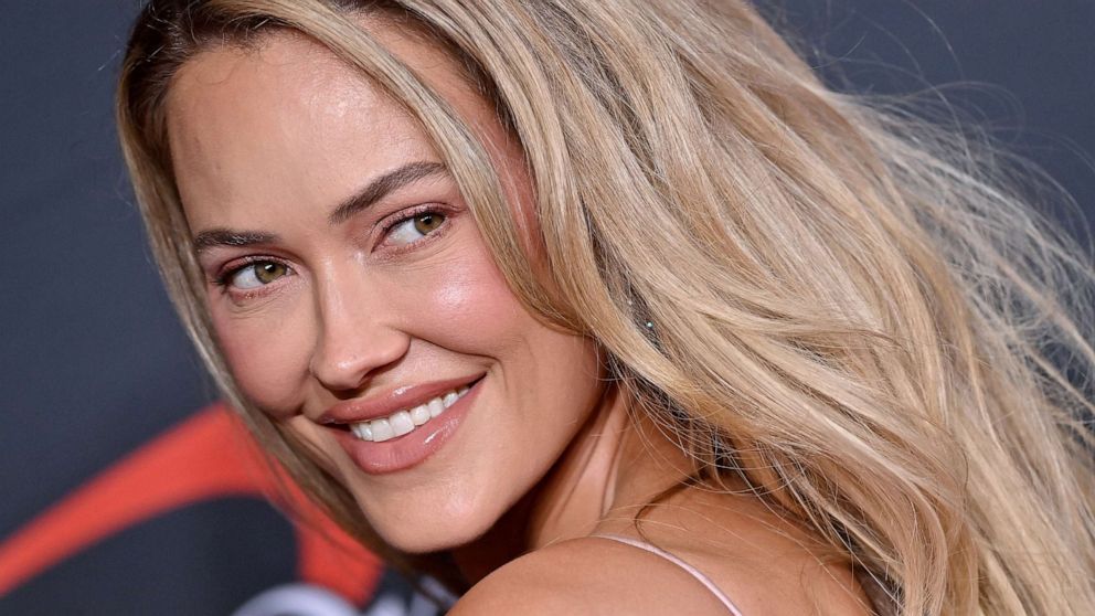 Peta Murgatroyd’s Speculated Plastic Surgery: Rhinoplasty and Lip Fillers Discussed